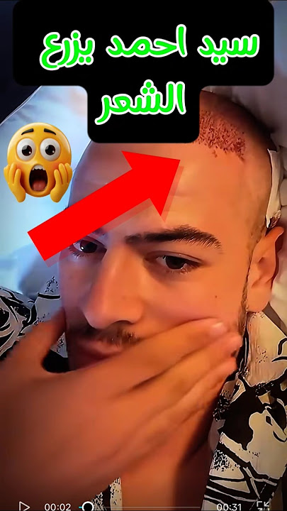 سيد احمد قمارجي يزرع الشعر هههه#algeria #tiktok #shorts #shortvideo#تيك_توك_المشاهير#قشيحة#اوبيرا