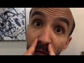 ابوعجيب انجلد وابوحصه فتنهم سنابات ابوحصه وابوعجيب ابوعجيب انجلد وابوحصه فتنهم سنابات ابوحصه وابوعجيب