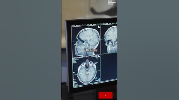 ✅Get ready to have your mind blown🤯🔥 || #facts #shortvideo #edumex #education #animated