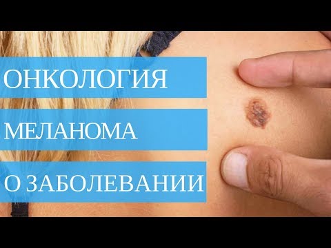 Video: Multipleksna Kvantitativna Analiza Fibroblasta Povezanih S Rakom I Ishod Imunoterapije U Metastatskom Melanomu