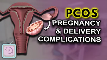 PCOS Pregnancy complications | High risk | Birth Defects?