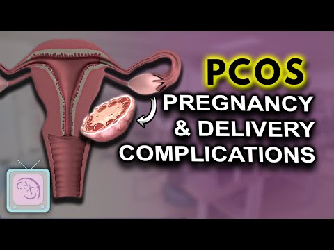 PCOS Pregnancy complications | High risk | Birth Defects?