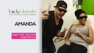 Underarm Laser Hair Removal in Miami Beach with Amanda - Body Details