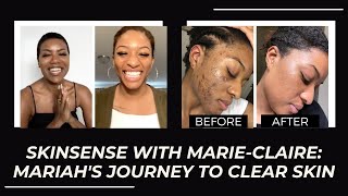 SKINSENSE WITH MARIE-CLAIRE: MARIAH'S JOURNEY TO CLEAR SKIN