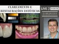 Clareamento e restaurações estéticas - Conteúdo da Live 3