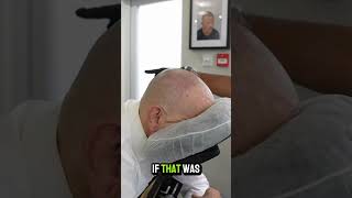 Food and hairlines…… #scalpmicropigmentation