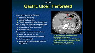 Gastric Causes of Acute Abdominal Pain on MDCT (Non-Malignant)