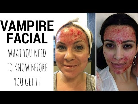vampire-facial---what-you-need-to-know-before-you-go-under-the-needle