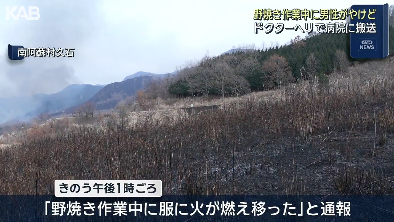 野焼き作業中の50代男性がやけど「服に火が燃え移った」