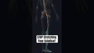 Stop Stretching Your Sciatica (Do THIS Instead) #sciatica #sciaticarelief #backpainrelief