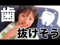 歯が抜けそう!!ののかの歯が抜けるまでの1週間【ここのの】