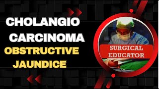 CHOLANGIOCARCINOMA  /Obstructive Jaundice