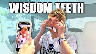 Our Son Has Surgery Secrets Revealed