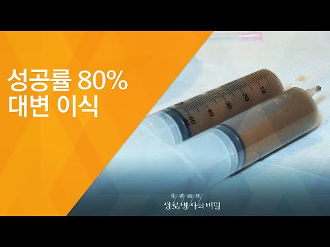 성공률 80% 대변 이식 - (2017.6.28_626회 방송)_당신이 오해하고 있는 해독의 비밀