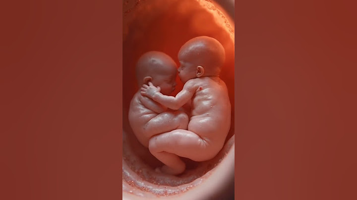 Twins baby inside the womb #twins #twinsbaby #baby #shorts