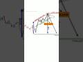 💥Candlestick Charts Explained — Can You Actually Learn This #Trading #StockMarket #DayTrading #fyp