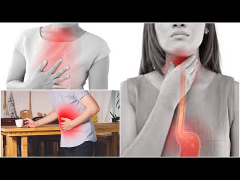 Βίντεο: Τι είναι η αίσθηση καψίματος στο στομάχι;