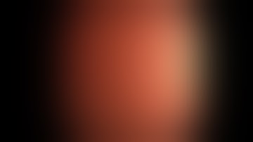 Endobiliary polypectomy of biliary tumor using a prototype dedicated cholangioscope