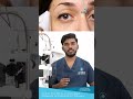 What to Do If Dust Gets Into Your Eyes? | Best Eye Care Hospital in Hyderabad | #Retinova