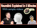 (Hindi) Neuralink: Elon Musk's new brain chip explained in 5 minutes !!