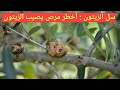 سل الزيتون  (العقد الدرنية ) : هل يوجد له علاج ؟