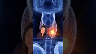 Thyroid Nodules Season 2 - Part 7 : My Benign Thyroid Nodule is Growing - What's Next?