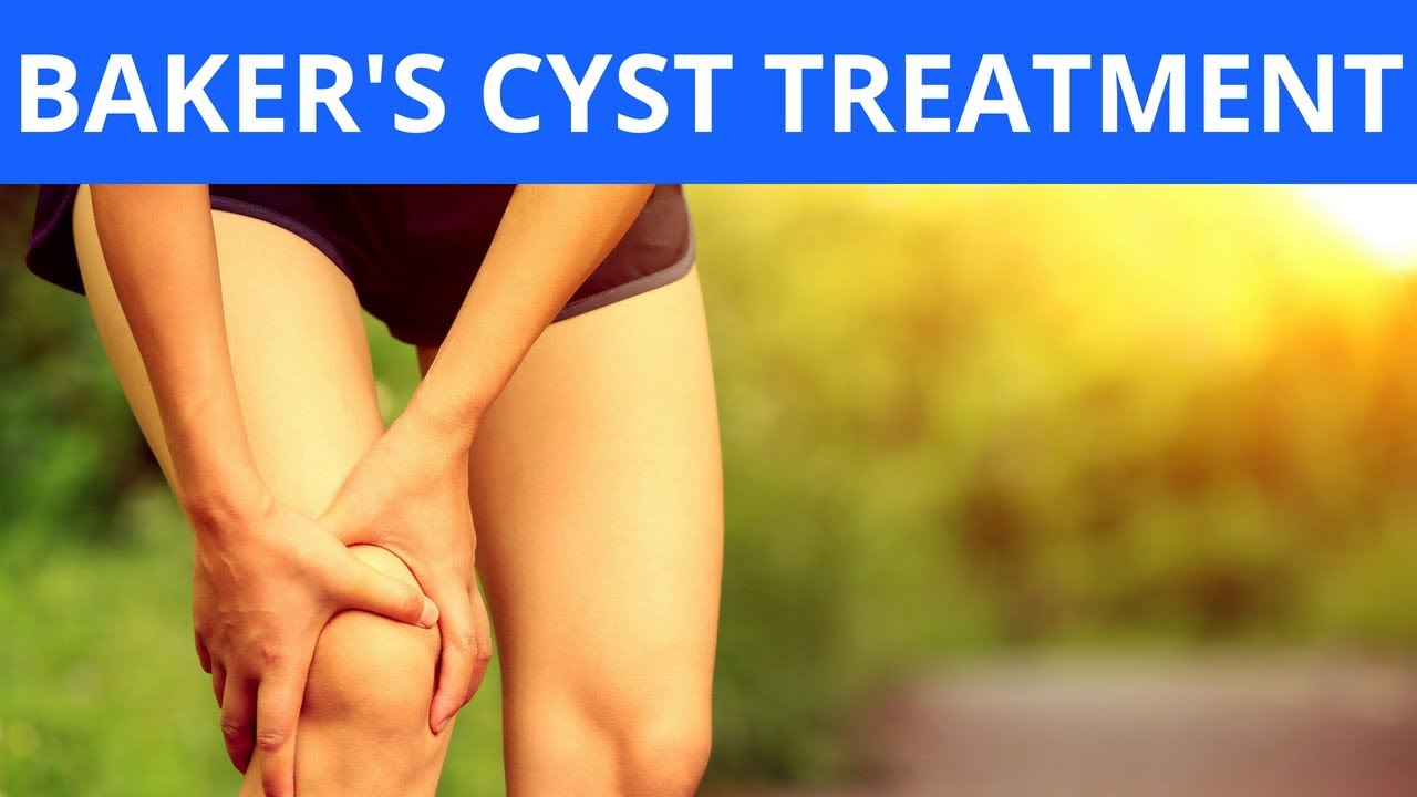 Baker's Cyst Treatment YouTube