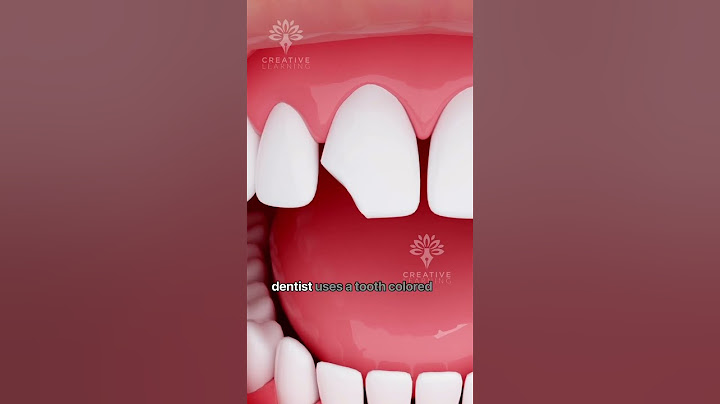 How Does Bonding Fix a Chipped Tooth #shorts #tooth - Creativelearning3d