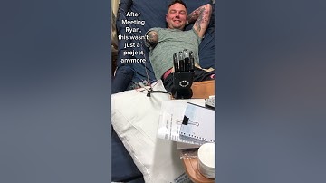 5 Years of Building A Bionic Hand