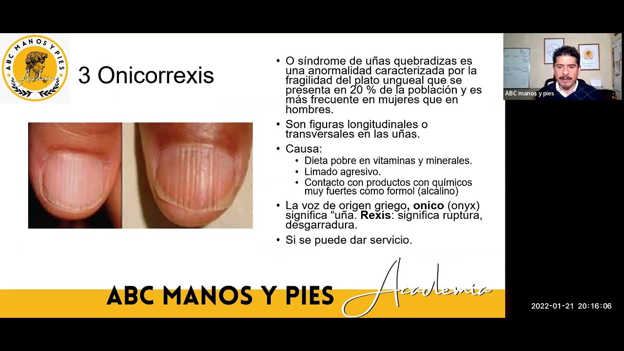 Enfermedades de las uñas | ABC manos y pies La Academia