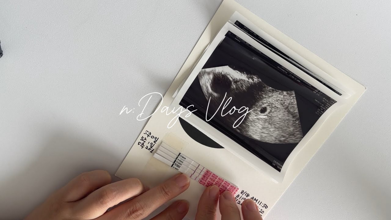 10:Days 임신5주차 브이로그 | 임산부등록 | 부모님임밍아웃 | 임신바우처신청방법