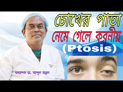 ভিডিও: হাওয়ায় পাপড়ি পরে কি?