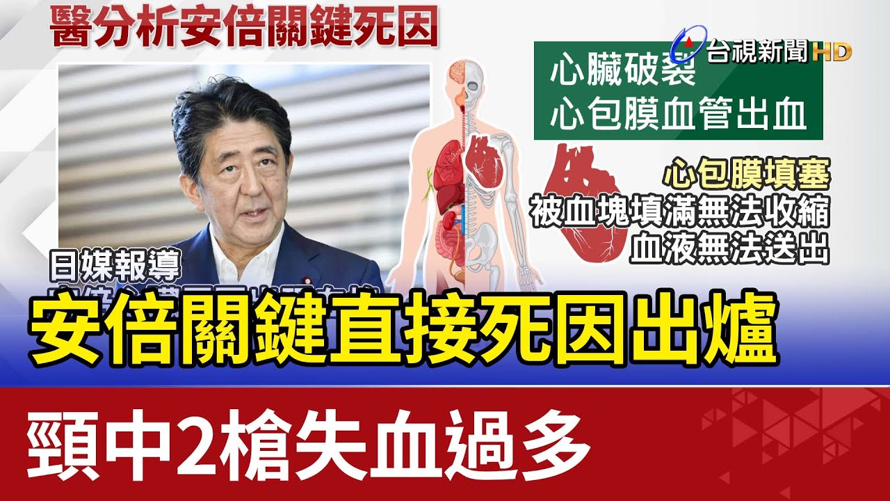 安倍晉三死因「動脈損傷失血過多」　專家：槍傷最難處理｜#鏡新聞