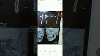 gift to identity fraud guy, yogendra nikale went through this, get his x ray done, he organized this