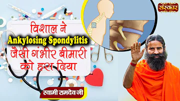 विशाल ने Ankylosing Spondylitis जैसी गंभीर बीमारी को हरा दिया | Swami Ramdev Ji | Sanskar TV