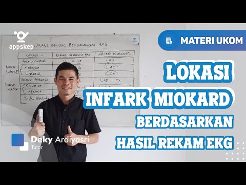 Video: Infark Miokard Pada EKG: Foto Dengan Decoding, Tanda Utama