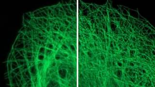 Huygens Deconvolution