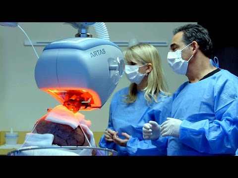 Dr. Craig Ziering on Why ARTAS Robotic Hair Transplant