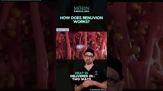 How Does Renuvion Work? #renuvion #drmoein #beverlyhills