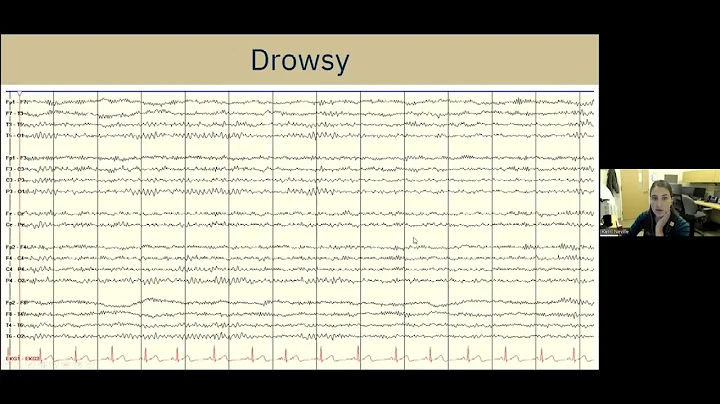Understanding EEG: A Practical Guide for Patients and Families