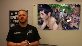 Celebrity Does Cupping Really Work? Profile