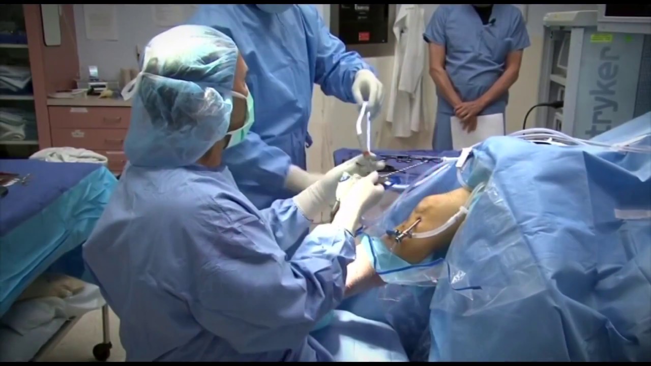 Microsharp Inject Needle Find Out How Microsharp Needles Develops Medical Sutures In This Video ...
