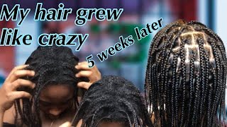 Do this once every 6 weeks and your hair will grow and retain length | mini braids for hair growth