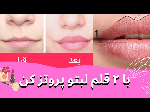 تصویری: منظور از اینکه کسی را پوتز خطاب کنیم چیست؟