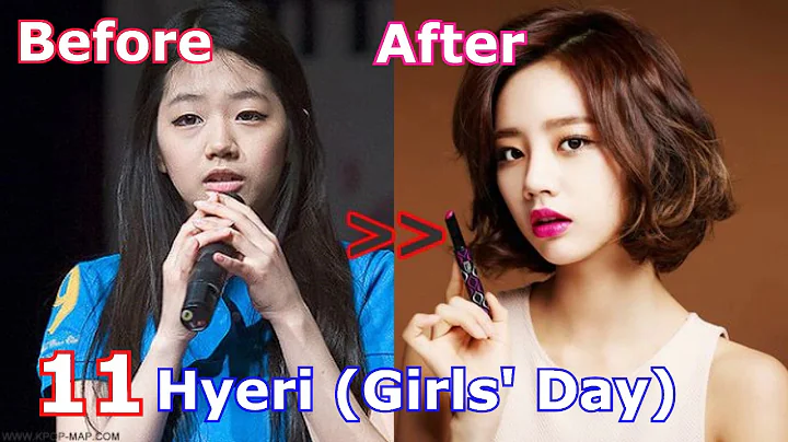 TOP 20 Korean Idols Before and After Plastic Surgery - DayDayNews