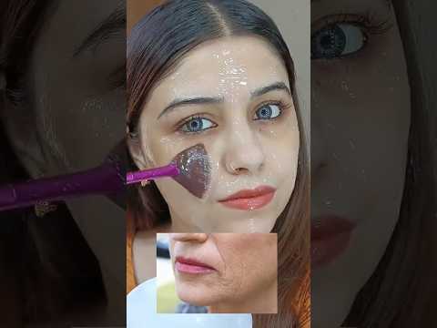 Sanya Butt skin care routine Acne sacar pigmation uneven skin tone #vairalvideo #shotviralvideo