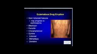 Atopic Dermais Fonacier