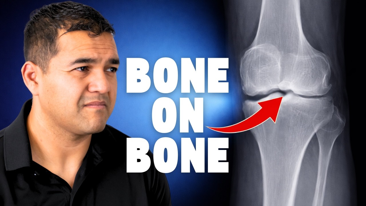 What Can You Do for BONE on BONE Knee Pain Relief? (without Surgery ...