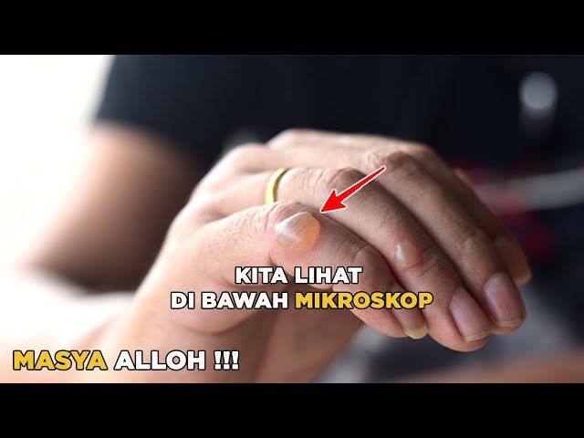 Kuasa Alloh !!! Lihat Isi Cairan Ini Di Bawah Mikroskop class=