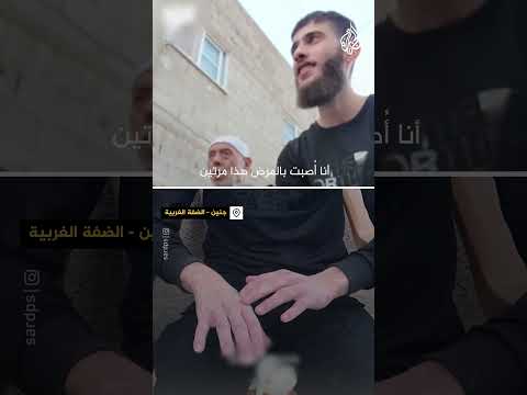 أسير محرر يروي إصابته بمرض جلدي منتشر بالسجون